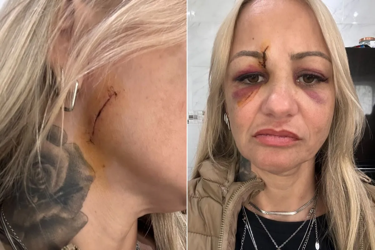 Cabeleireira agredida com taça em Praia Grande